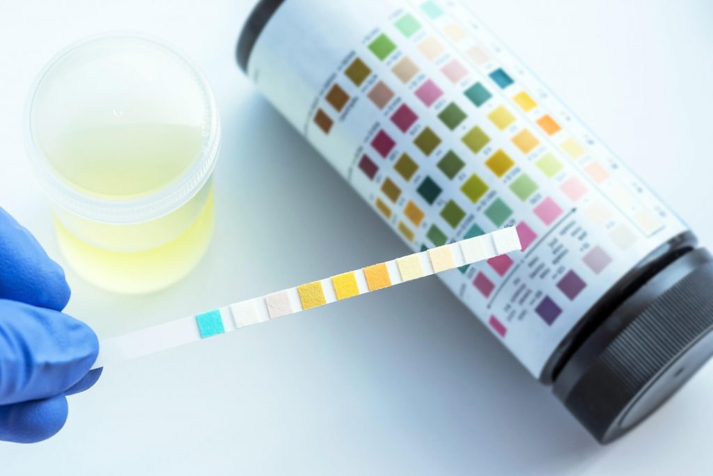 Why Urinalysis is Critical to Your Success